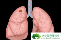 ���ڷΰ����߷��ð������ᷢ����Ѫ������Ҫͣҩ��