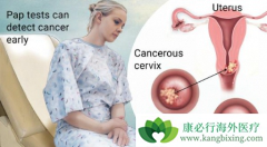 �ڷ�PARP���Ƽ�ά���������ƹ��������ߵ���Ч��ô����