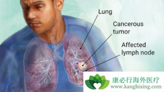 PARP���Ƽ���Сϸ���ΰ�����������о���չ