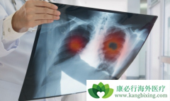 ���������ڷ�Сϸ���ΰ�һ�������е�Ӧ��