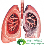 �ط��Է���ά���ܻ��ã�Ŀǰ����Щ����ҩ�