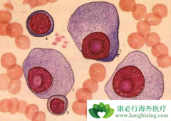 �෢�Թ���������Ҫʲô������Щ��������ҩ�