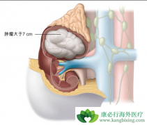 ��ϸ���������VHL�ۺ�����ʲô������