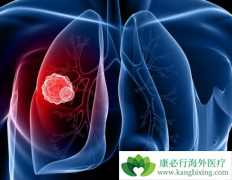 ��������(Alunbrig)���һ��ALK���Ƽ����и��õ�­����Ч