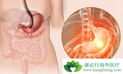 �����߼������Ƽ���������θ���ܻ��ã�