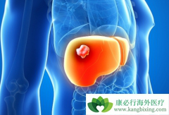 �ΰ����Ʒ�����ôѡ�����������ʺ����ָΰ����ߣ�