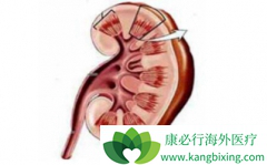 �����������ܻ��ã��������������ӳ�����ʱ����