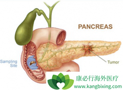 ���������������ٰ��ĸ�Σ��������Щ��