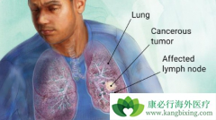 EGFRͻ������ڷ�Сϸ���ΰ�����ʹ�ð���ҩ���ƻ����������ƣ�