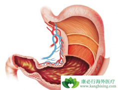 ��ɼ���Ͷ�����ɼ��������Ϊ��չ��θ�����ߵ�һ����ҩ