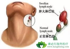 �ܰͰ��ķ���ΪʲôԽ��Խ���ữ������Щ�����йأ�