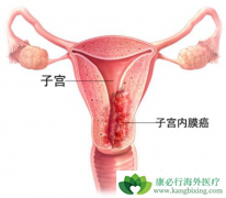 ���������������뻼������״���кܴ�Ĺ�ϵ