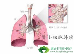 �̵����Ʒ�Сϸ���ΰ���ALK����ҩ������Щ