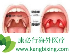 �����尩���շ���������Щ��֢״��������Щ��