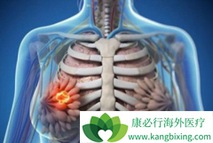 ��Щ���ٰ�������Ҫ�����鵥���������ƣ�