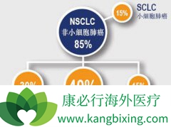 ���䲢����Ӱ�������Сϸ���ΰ����߽��ܱ�׼�Ż��Ƶ�Ч��