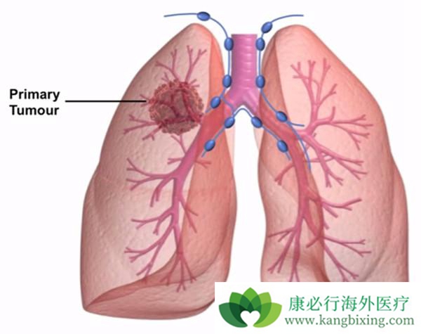 �ζ�����ѹ 