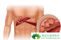 �ΰ����Ʒ������ѡ�����������ʺ�ʲôʱ���ã�