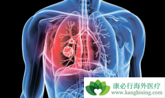 ���۰������ڷ��ð��������ڼ�Ҫ���г�Ѫ���չܿ�