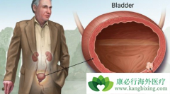 ����װ��Ȱ�֢���ձ鰩֢�����ʴ���Ƕ��٣�