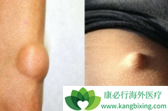 ��̹/��������������Ϊ���������Ķ�����ҩ