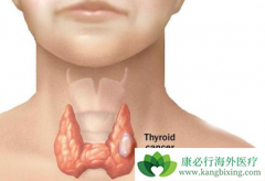 С��ͷ״��״��������ô���ƣ�������ҩ��������