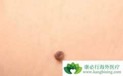 �˽�Ƥ����֢������֢״�����ڻ������տ�ʼ����