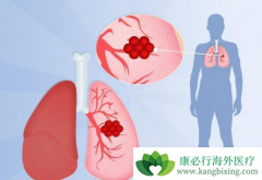 ���������зΰ����߶����еķΰ�������ǰ֢״