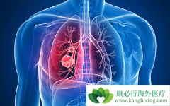 �������/�����������EGFR�ΰ�һ��ҩ�������Щ�ر�֮����