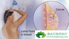 HER2�������ٰ����������ٰ����¸����Ʒ�����Щ��