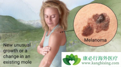 Binimetinib����NRASͻ���ɫ�������ߵ��ٴ�����Ч����ô����