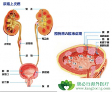 ������ҩvofatamab����������·��Ƥ�����ߵ���Ч��ô����
