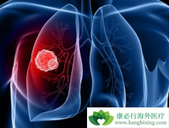 ��EGFR���Ƽ������������ڷΰ�ʱ���ٵ����⣿