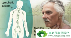 �ǻ�����ܰ�����ҩumbralisib��FDAͻ�����Ʒ��϶�