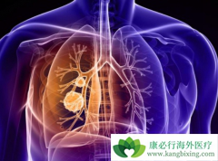 �ΰ������ܻ��ã��ΰ���������Щ֢״�Ƚ����ԣ�