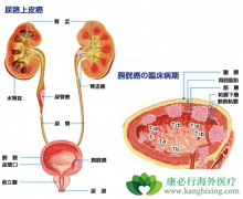 ������·��Ƥ��ʹ��CTLA-4��������PD-1���Ƽ�����Ч