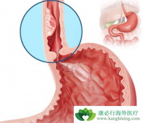 ����Сϸ���ΰ��������ỹ������ʳ���۰�