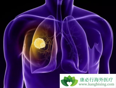 ��ͬ������ת����������ϰ�ά͡/����˹͡�Ƿ��в��죿