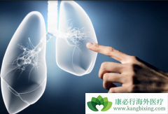 PARP���Ƽ�Olaparib���нϺõĿ�Сϸ���ΰ��Ļ���