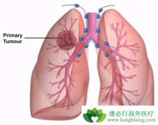 ���ڷΰ����������ƶѪ����ô�����أ�