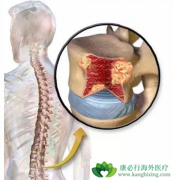 �෢�Թ���������ƶѪ����Ҫ��ԭ������Щ��