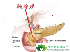 �������ٰ��ķ��������������ƻ�����Щ��