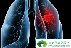 �������(Vizimpro)���ٴ�Ч���ͼ����������ʲô��ͬ��