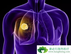 ��Сϸ���ΰ���ת�ƺ��ȳ������ô���£���ô���ƣ�