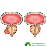 ǰ���ٰ������ö�������ǰ��Ҫ���ʲô��