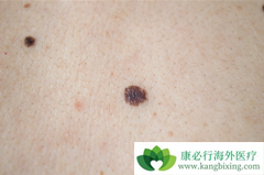 ���ڼ�⵽�ĺ�ɫ��������ͨ���������Ƶ����������ʸߴ�99��