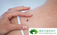 ���º�ɫ����������������Ҫ����Щ��