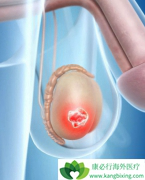 غ�������Ƕ���������غ������������ʲô֢״��