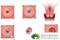 �����������ܻ����뻼�����ʺ����Ʒ������