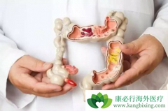 �᳦�������ܻ�������Щ����Ӱ�죿